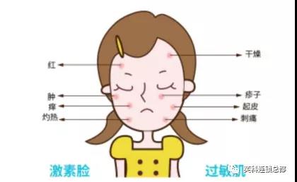 奕科敏感肌（激素脸）十项检测法